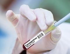 AstraZeneca отстает от графика поставки своей вакцины против COVID-19