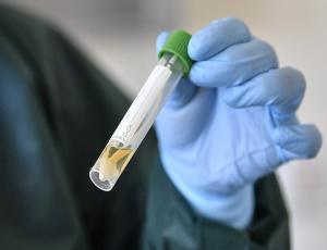 В США разрабатывают экспресс-тест на антиген коронавируса